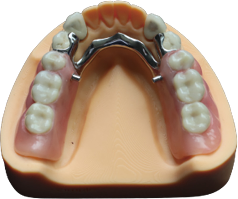 Full Upper and Lower Thermosens Partial Denture Full Acrylic